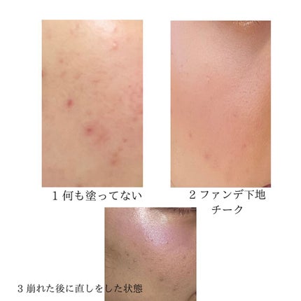 ピンクティーツリーカバークッション/APLIN/クッションファンデーションを使ったクチコミ(2枚目)