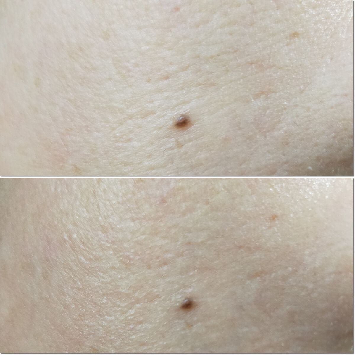 リードルショット700/VT/美容液を使ったクチコミ（2枚目）