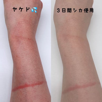 CICA ケアクリーム/BEAUSTA/フェイスクリームを使ったクチコミ(6枚目)