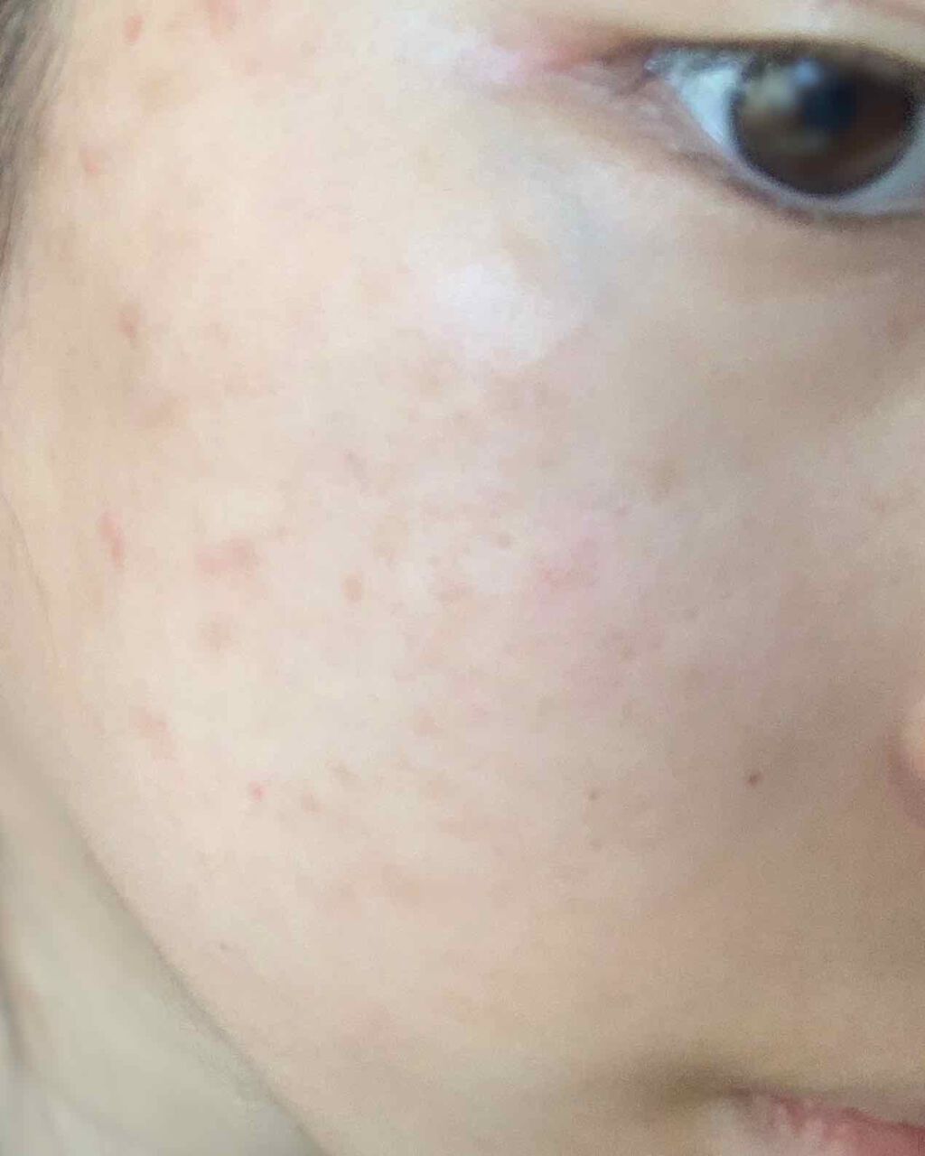 サンホワイトP-1/サンホワイト/ボディクリームを使ったクチコミ（2枚目）