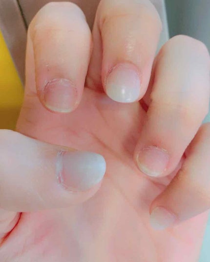 ハンドベール プレミアムリッチネイル/メンソレータム/ネイルオイル・トリートメントを使ったクチコミ(2枚目)