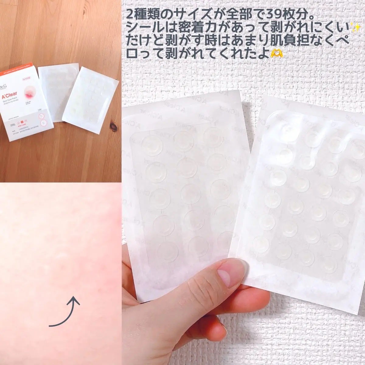 エイクリアスポットキュアパッチ/Dr.G/その他スキンケアを使ったクチコミ(3枚目)