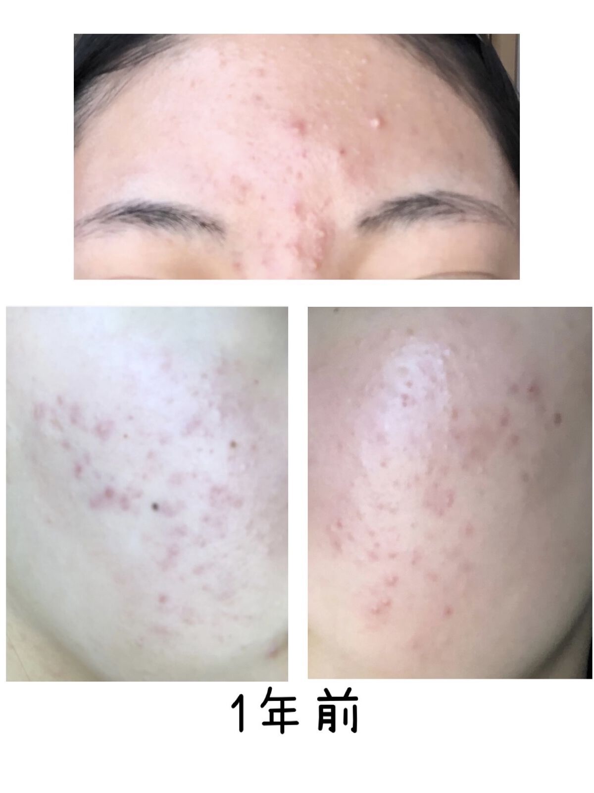 チョコラBBプラス (医薬品)/チョコラBB/その他を使ったクチコミ（2枚目）