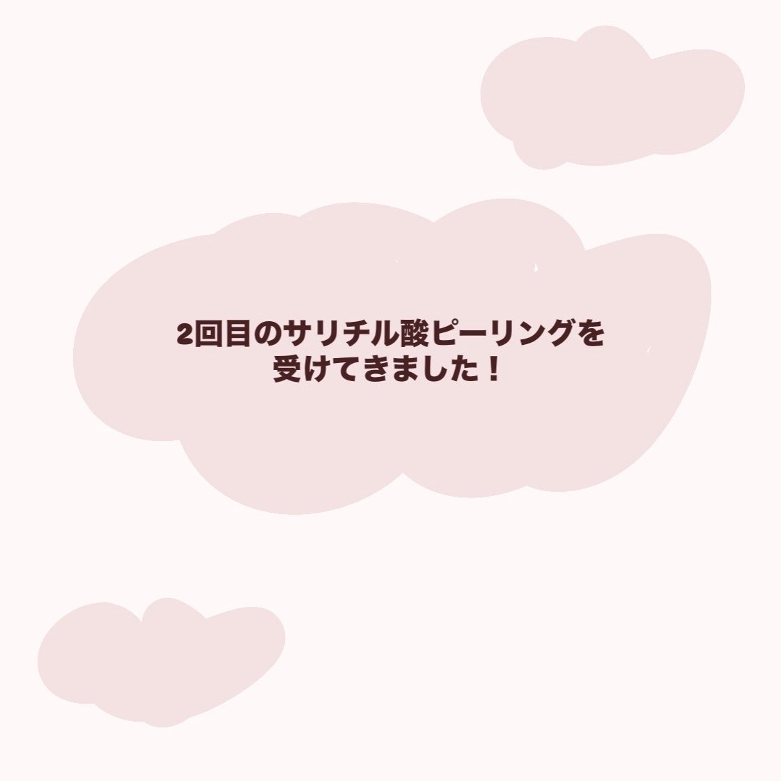 お芋ちゃん|10年以上ニキビに悩む保育士 on LIPS 「サリチル酸ピーリングを受けてきました。最近花粉の影響なのかおで..」(1枚目)
