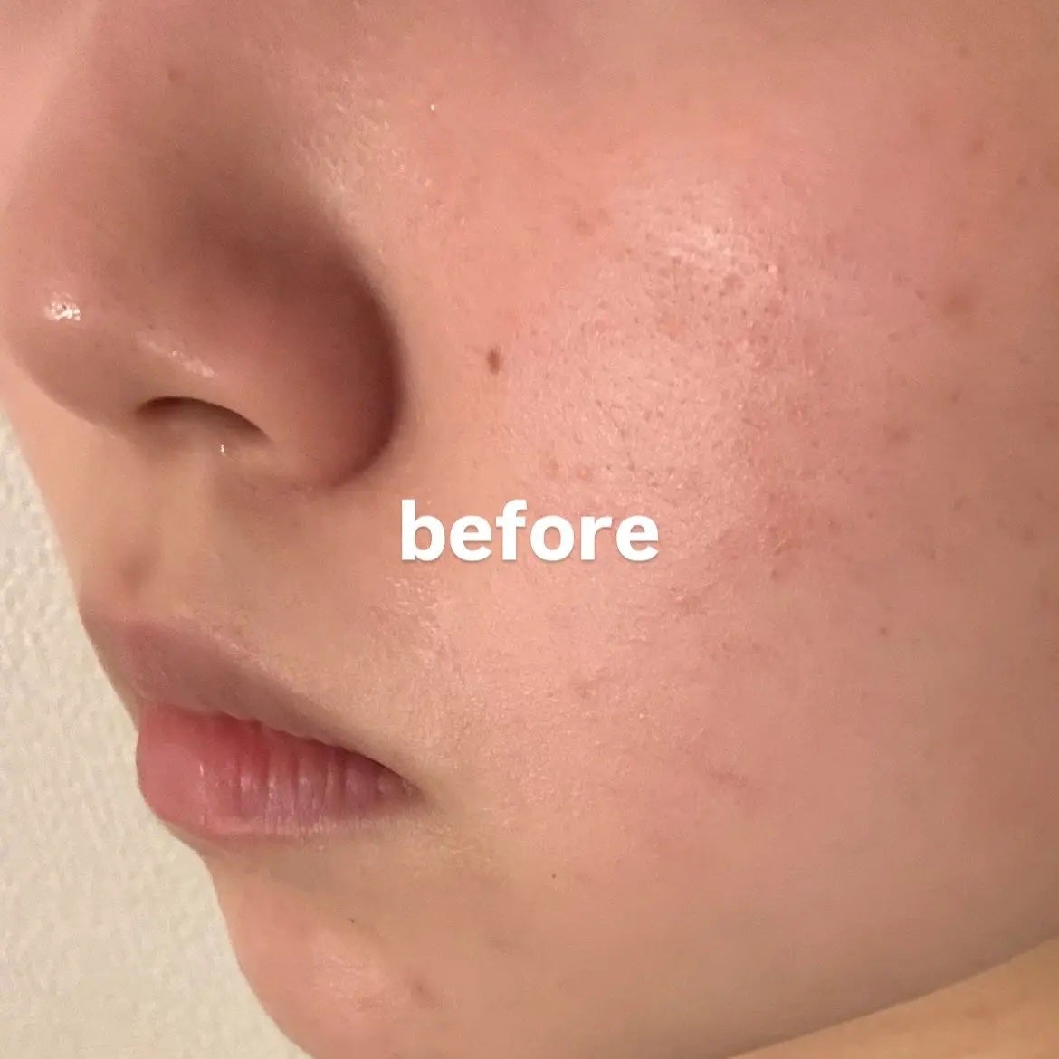 Lily on LIPS 「【花粉による肌荒れ対策に☀️】レッドブレミッシュシリーズの2種..」(3枚目)