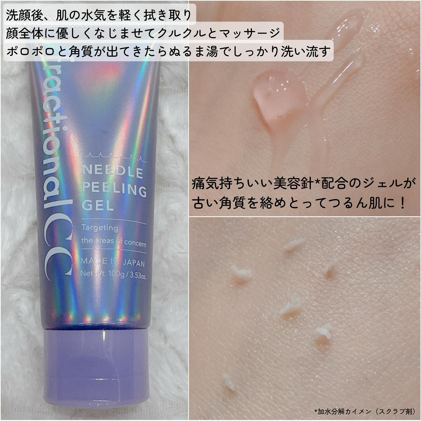 ニードルピーリングジェル/fractionalCC/ピーリングを使ったクチコミ（3枚目）