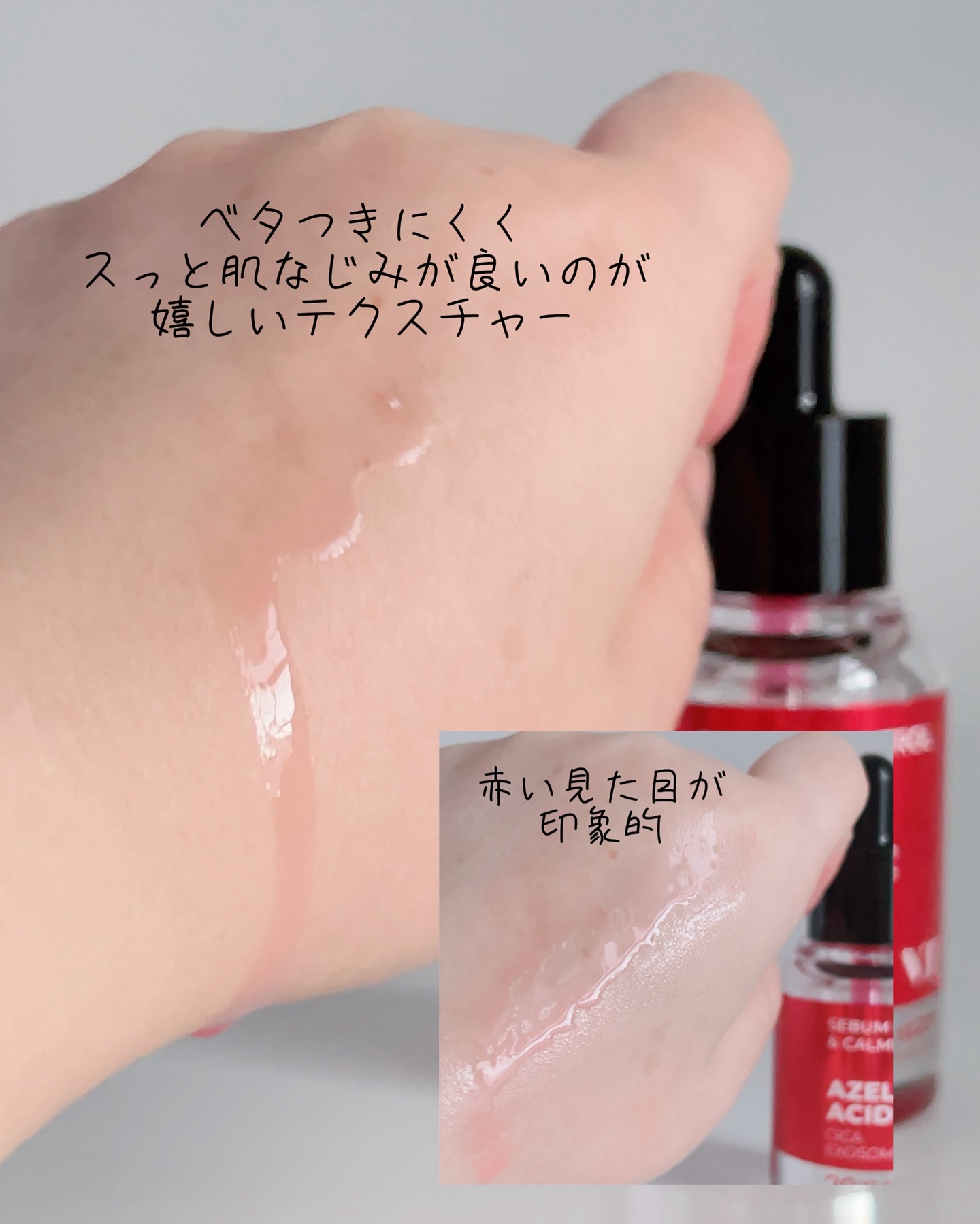 A1カーミング アンプル/VT/美容液を使ったクチコミ（3枚目）