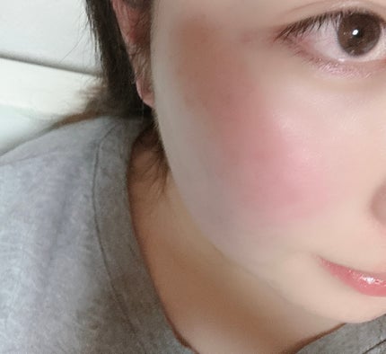 フォトピック カミング サリケア マスク/JMsolution-japan edition-/シートマスク・パックを使ったクチコミ(4枚目)