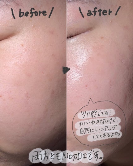 UVã€ã㢠XL ãããã¯ã·ã§ã³ããŒã³ã¢ãã ããŒãº+/ã© ããã·ã¥ ããŒ/æ¥çŒãæ¢ãã»UVã±ã¢ã䜿ã£ãã¯ãã³ãïŒ4æç®ïŒ