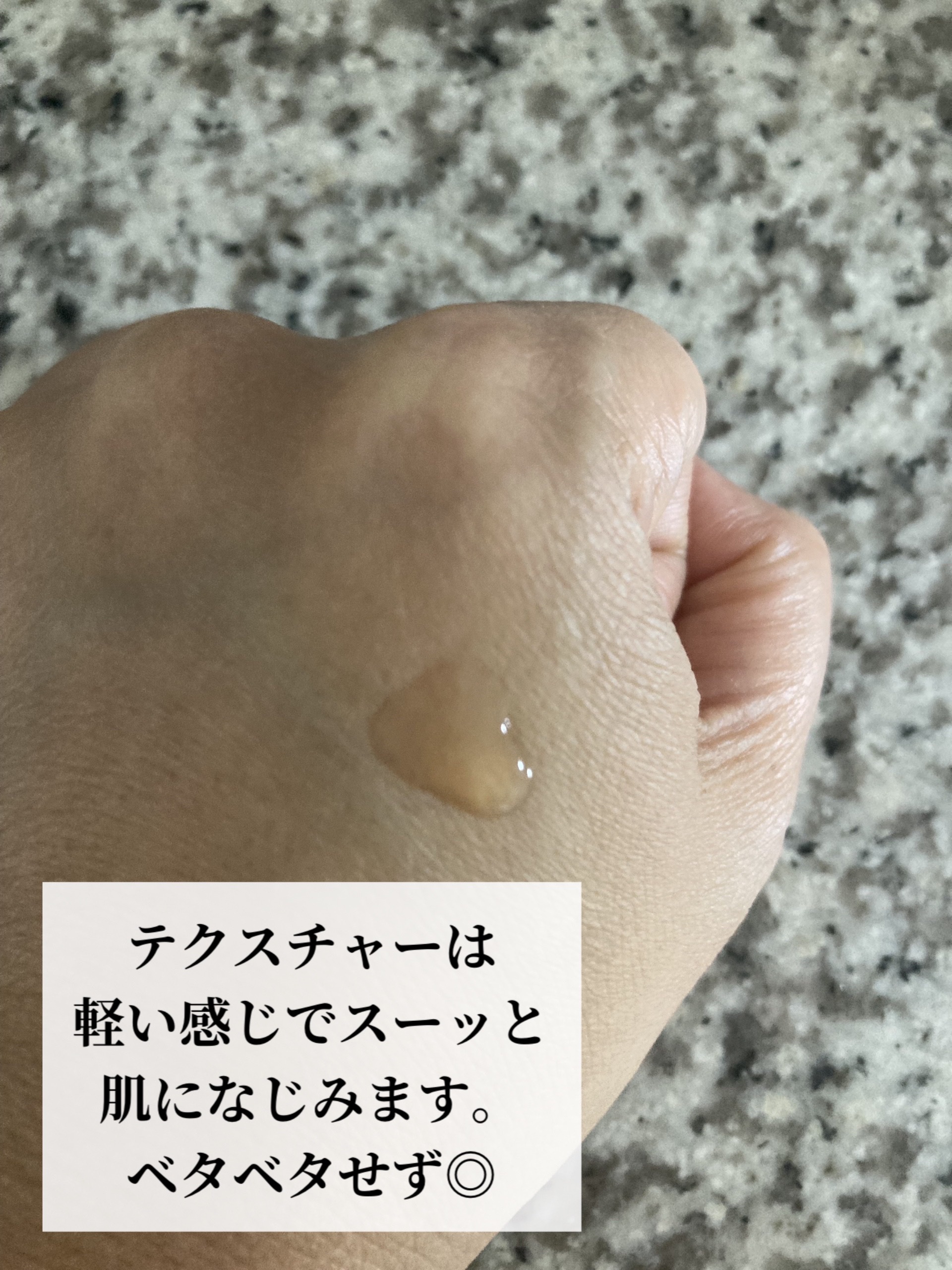 RXザ・アルファアルブチン2 ニキビ跡ケアセラム/COSRX/美容液を使ったクチコミ（3枚目）