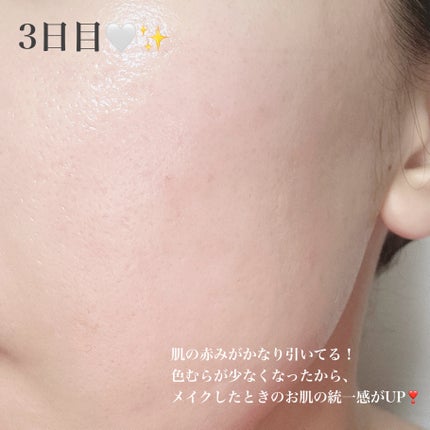 リードルショット300/VT/美容液を使ったクチコミ(4枚目)