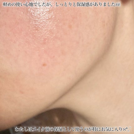 ライストナーパッド/I'm from/トナーパッドを使ったクチコミ(9枚目)