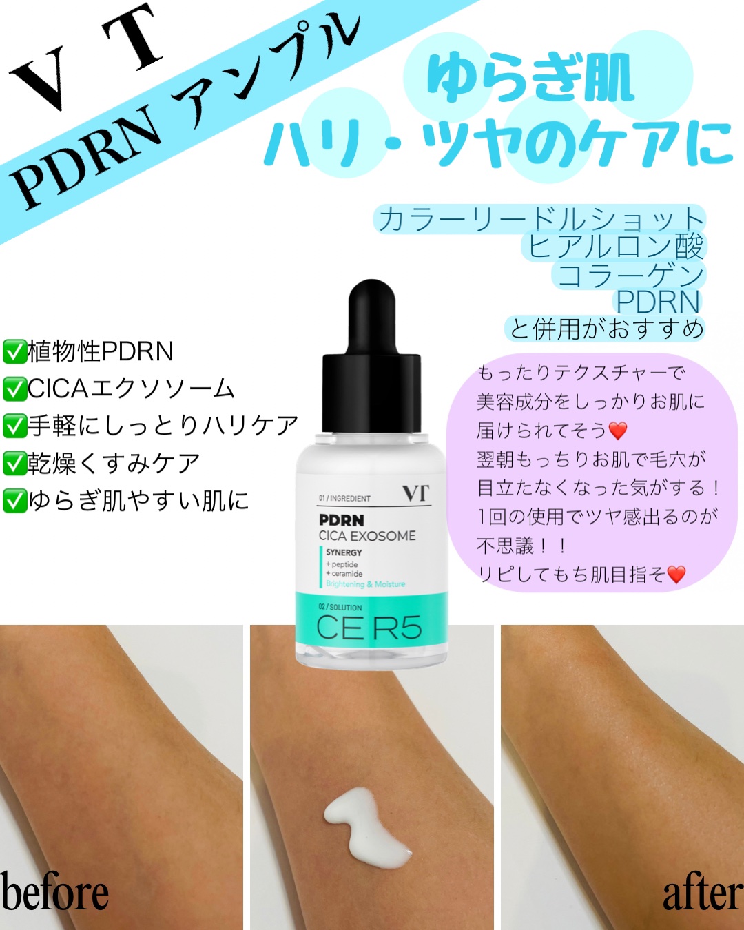 A1カーミング アンプル/VT/美容液を使ったクチコミ（3枚目）