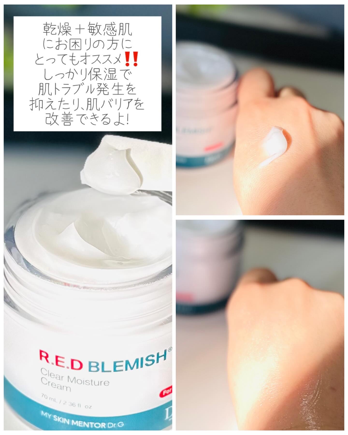 レッドブレミッシュ クリアスージングクリーム/Dr.G/フェイスクリームを使ったクチコミ（3枚目）