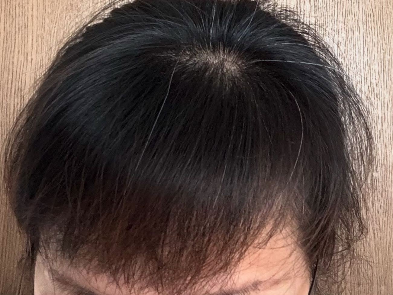 グローターン 100ml/リリーイブ/頭皮ローションを使ったクチコミ(5枚目)