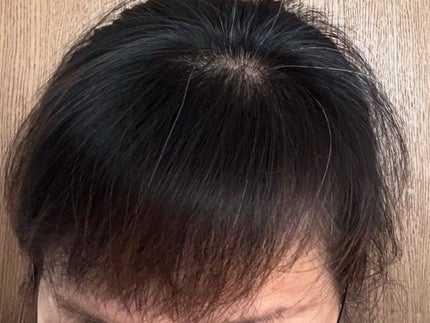 グローターン 100ml/リリーイブ/頭皮ローションを使ったクチコミ(5枚目)