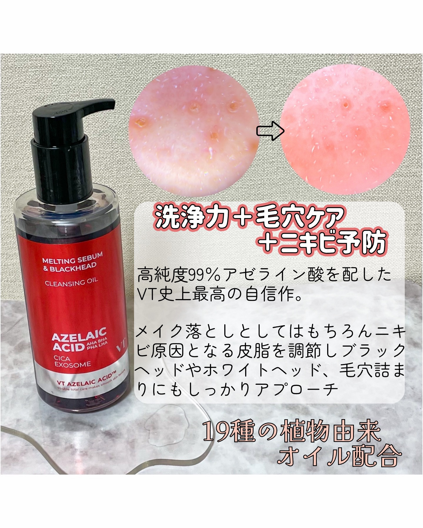 AZケア クレンジングオイル/VT/オイルクレンジングを使ったクチコミ（2枚目）