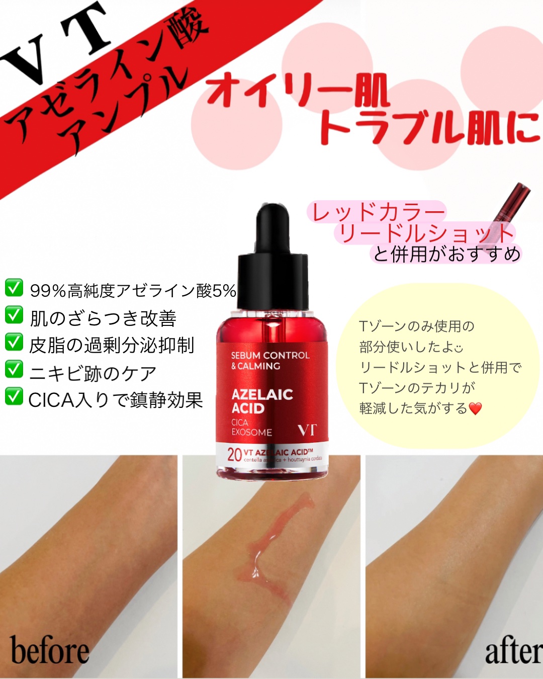 A1カーミング アンプル/VT/美容液を使ったクチコミ（2枚目）