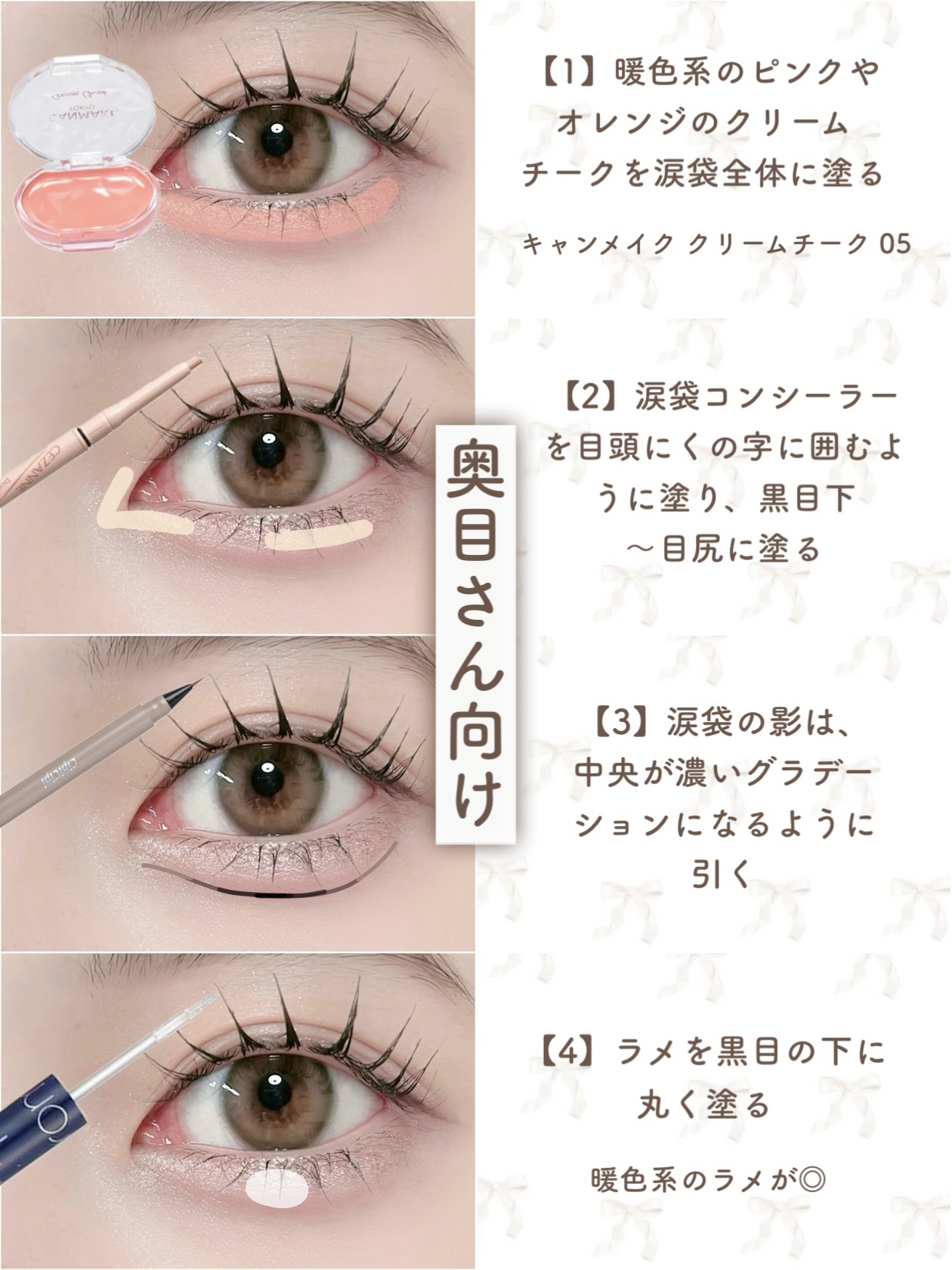 手渡し希望ベンアイパスティンガー