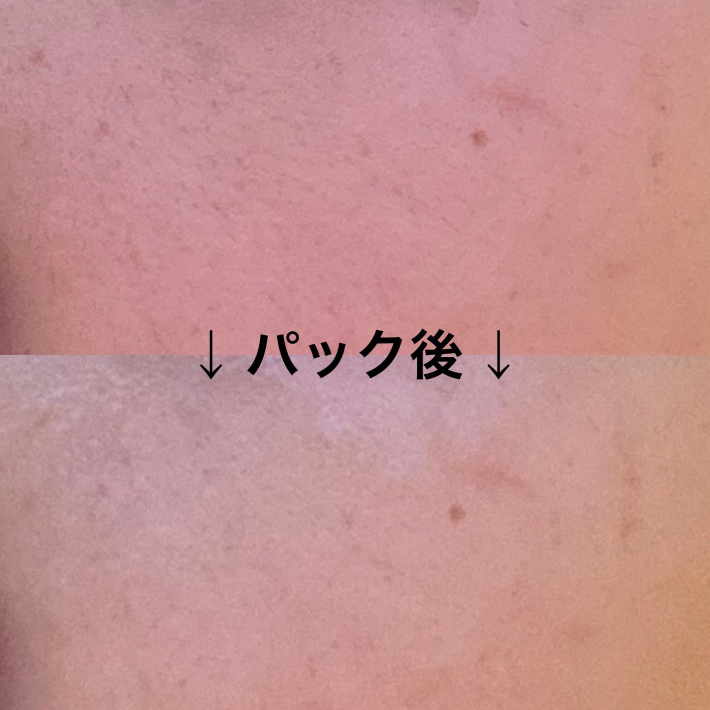 THE ナイアシン 3ミニッツマスク/MEDIHEAL/シートマスク・パックを使ったクチコミ(4枚目)