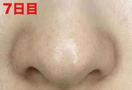 3番 緑茶炭毛穴パッククレンジングバーム/numbuzin/クレンジングバームを使ったクチコミ(3枚目)