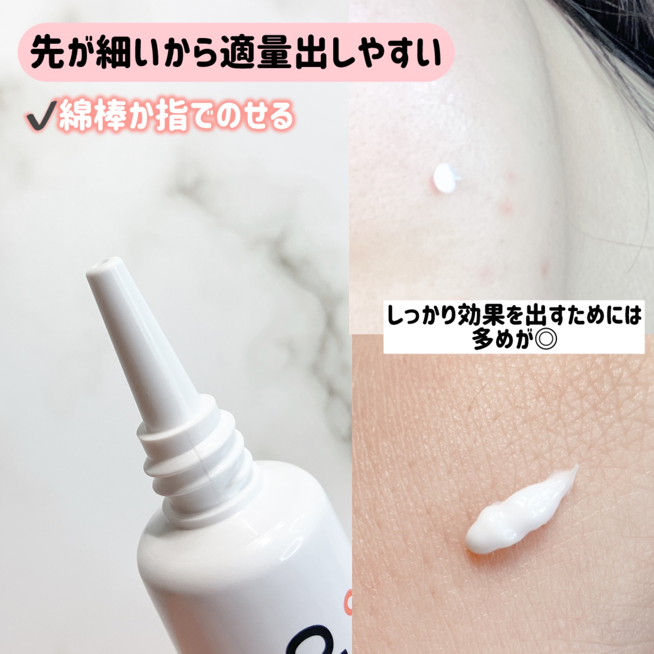 アクノンクリーム/東亜製薬/その他スキンケアを使ったクチコミ（3枚目）