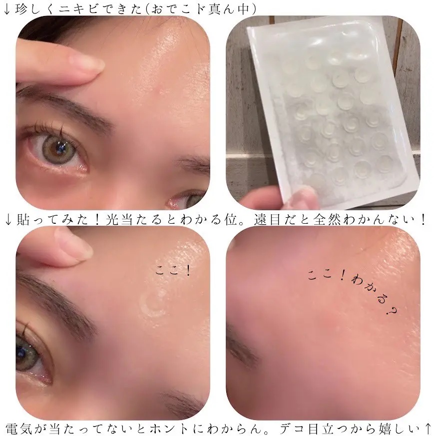 Dr.G Aクリアスポットパッチ/Dr.G/その他スキンケアを使ったクチコミ（1枚目）