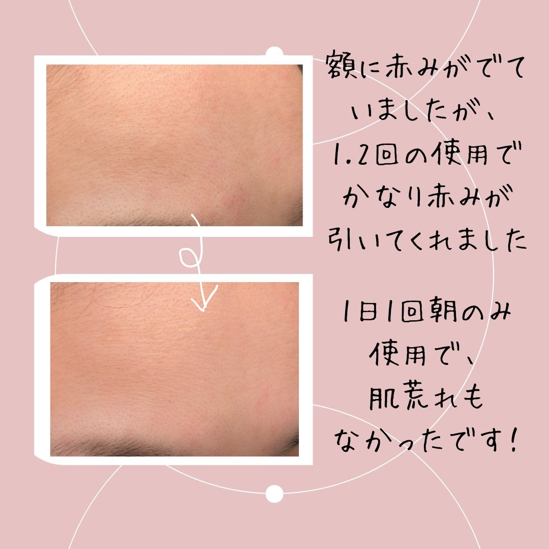 トーニングC ビタショットアンプル/Cell Fusion C(セルフュージョンシー)/美容液を使ったクチコミ(3枚目)