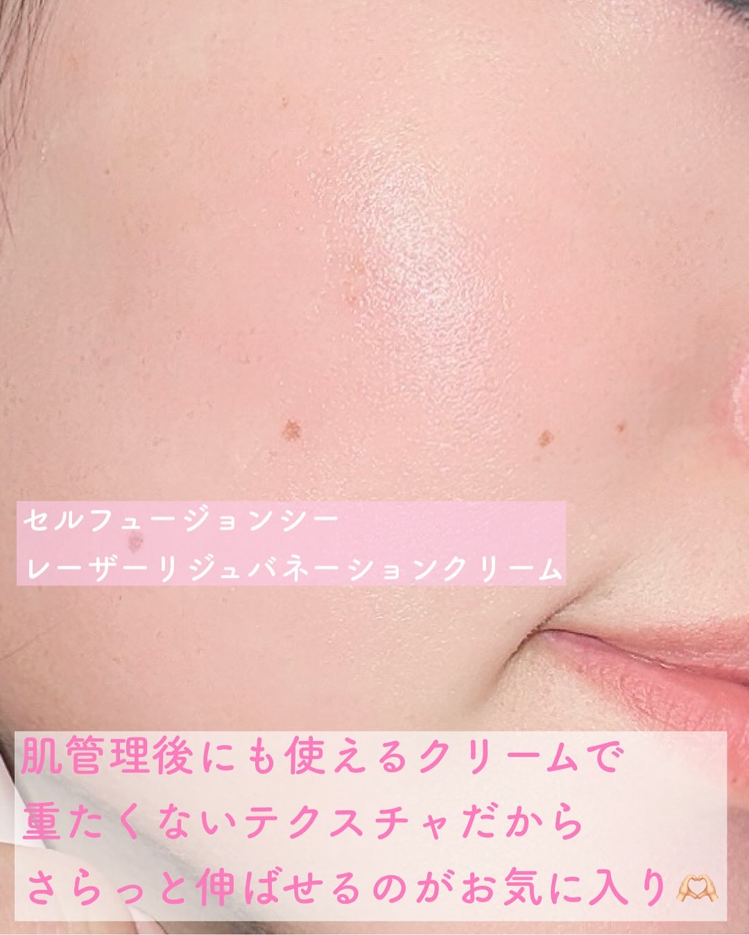 LASER REJUVENATION CREAM/Cell Fusion C(セルフュージョンシー)/フェイスクリームを使ったクチコミ（2枚目）