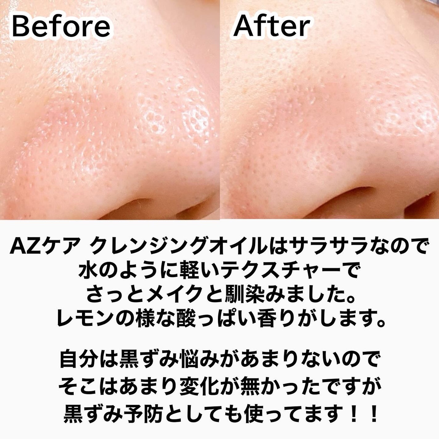 レッドブースター リードルショット100/VT/ブースター・導入液を使ったクチコミ(5枚目)