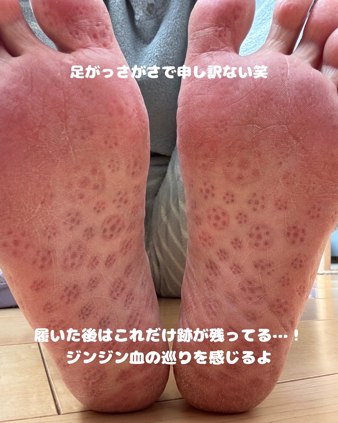 カロリング・ダイエットサンダル/BALLOP/レッグ・フットケアを使ったクチコミ（3枚目）