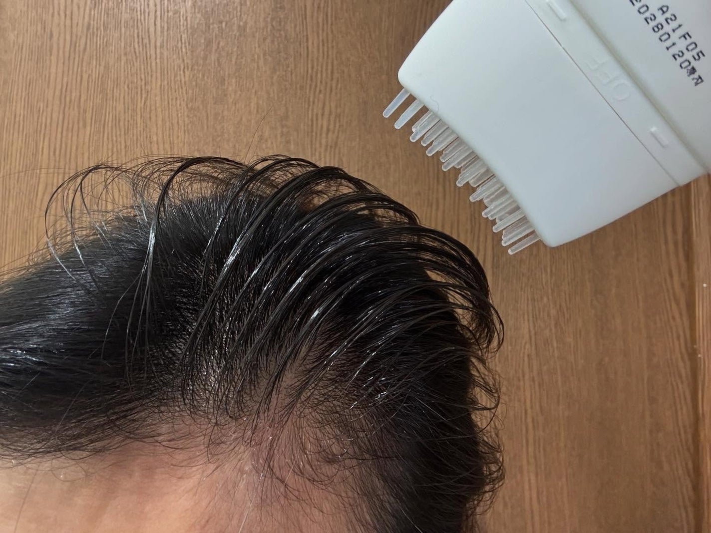 グローターン 100ml/リリーイブ/頭皮ローションを使ったクチコミ(4枚目)