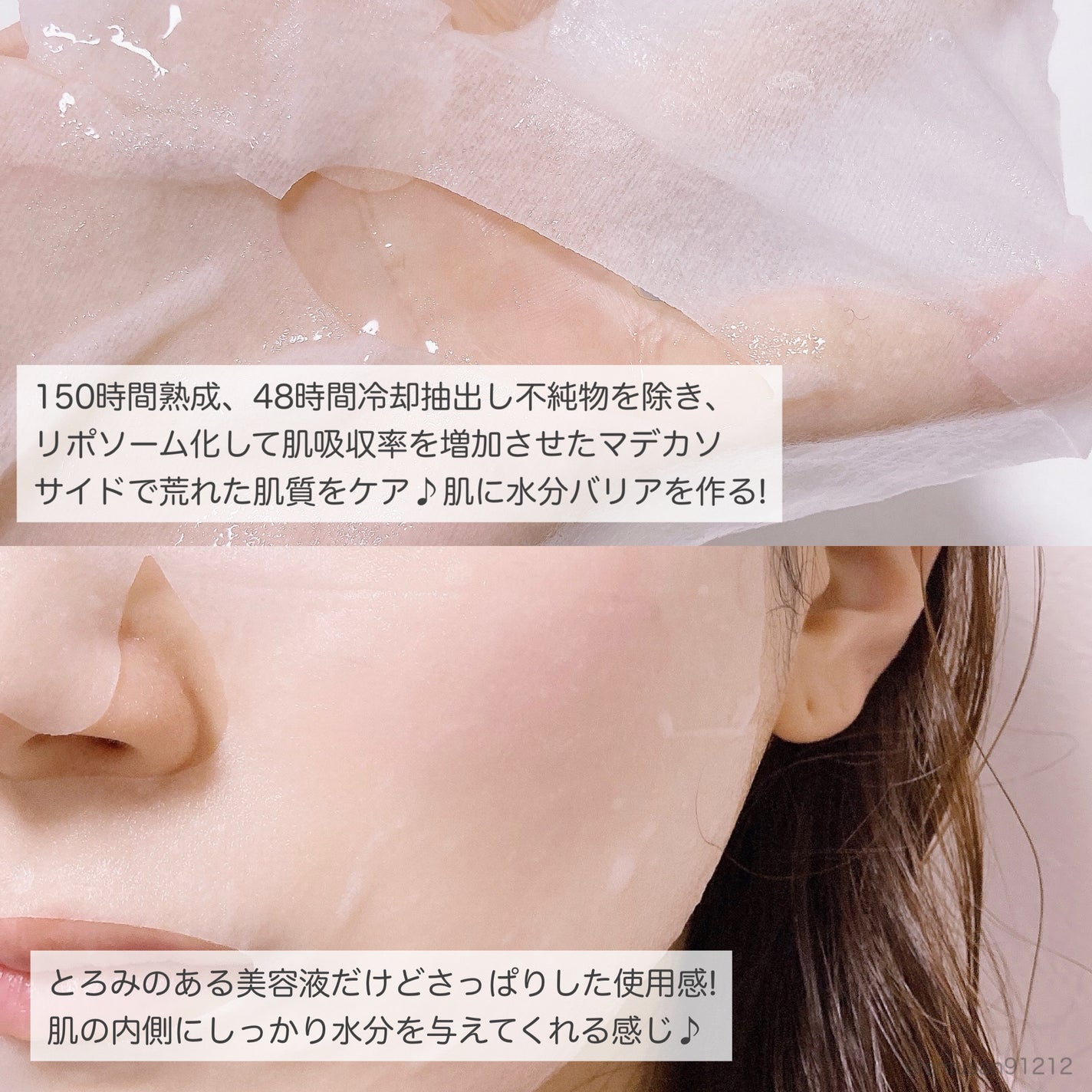 マデカソサイドエッセンシャルマスク/MEDIHEAL/シートマスク・パックを使ったクチコミ(9枚目)