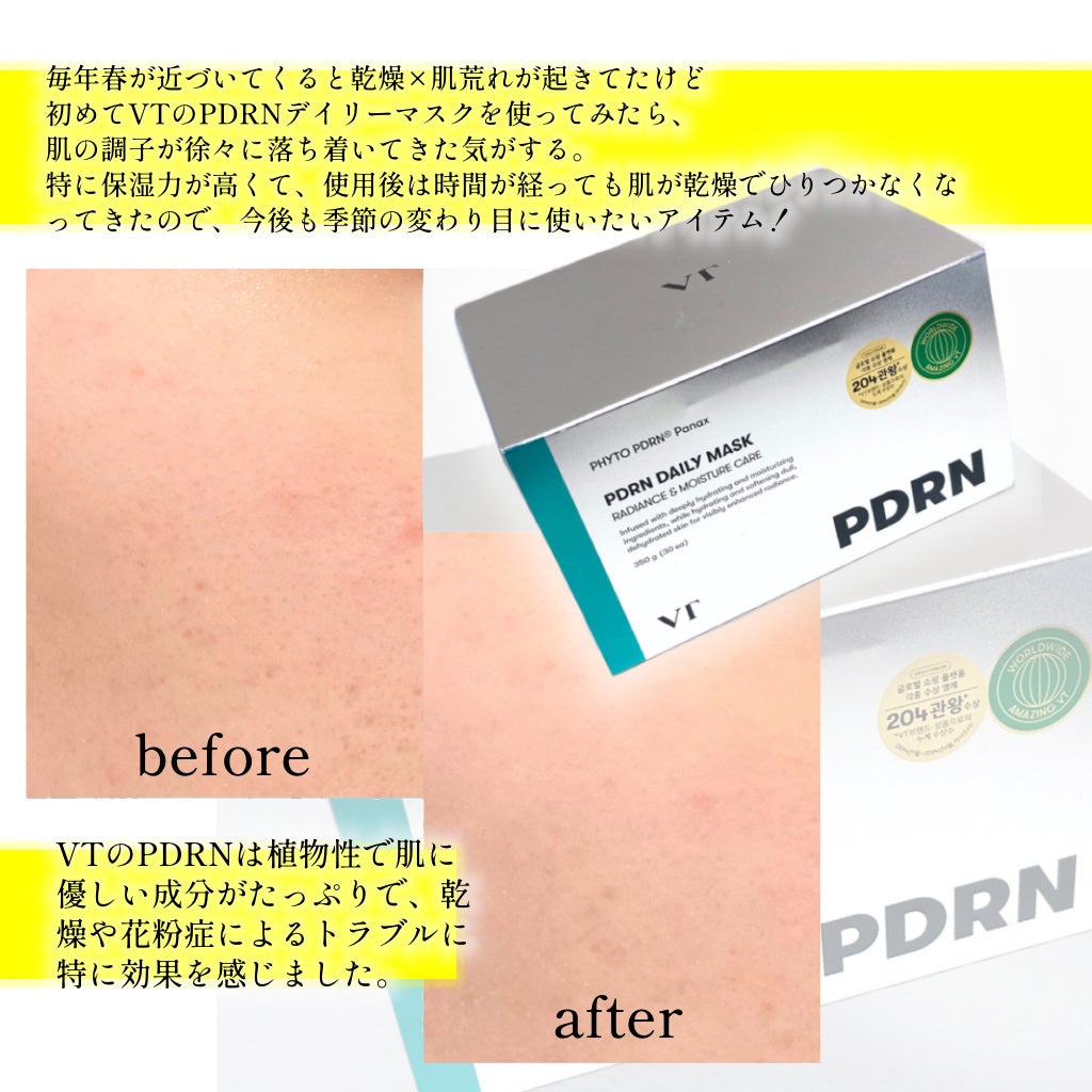 mashiro on LIPS 「#PR【3月5日限定】「PDRNデイリーマスク」1+1DAY✨..」(3枚目)