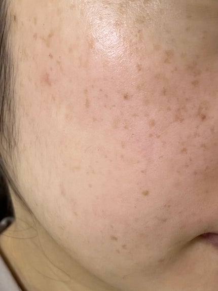 グルタチオンショットB3クリアトーントナー/It's skin/化粧水を使ったクチコミ(4枚目)