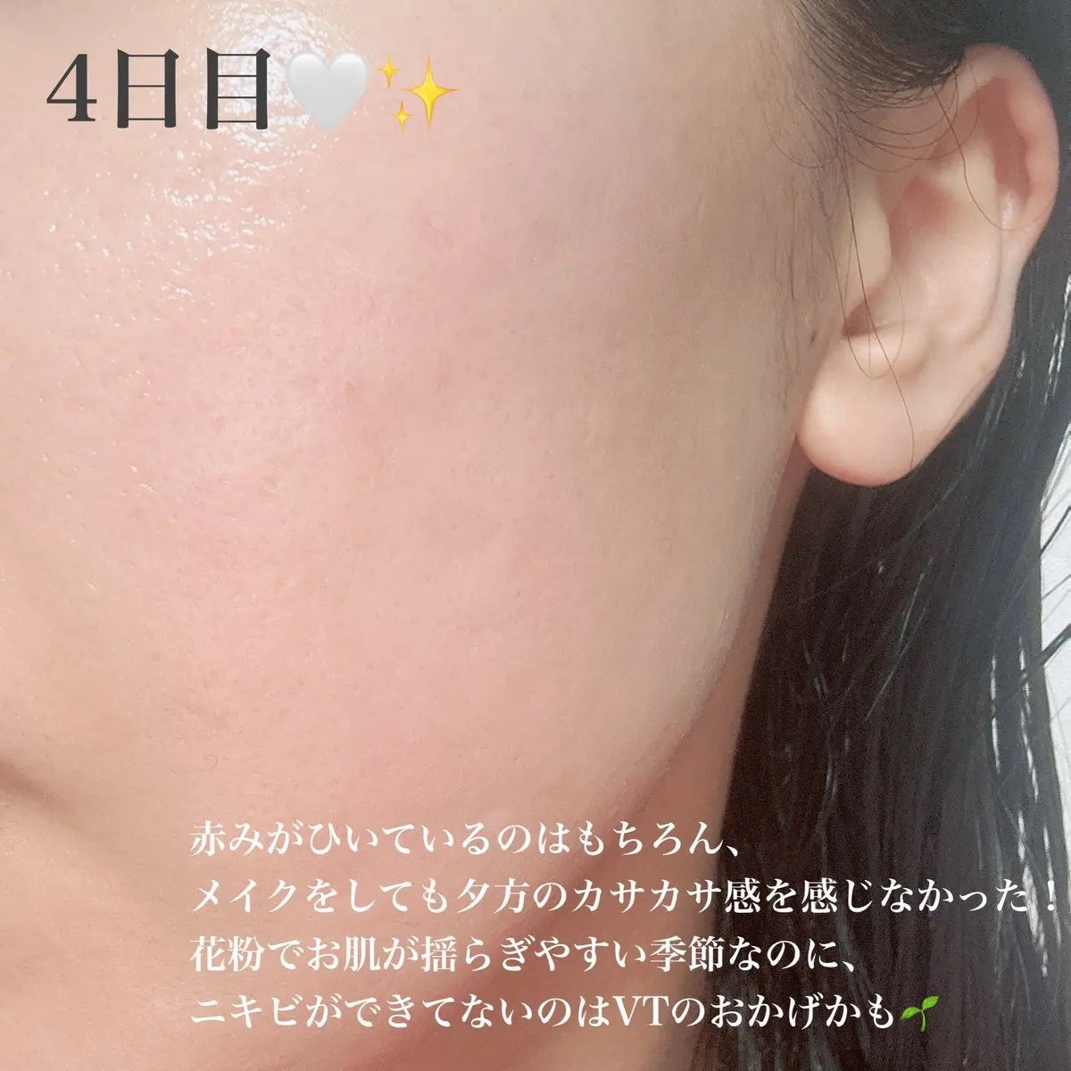 リードルショット300/VT/美容液を使ったクチコミ(2枚目)