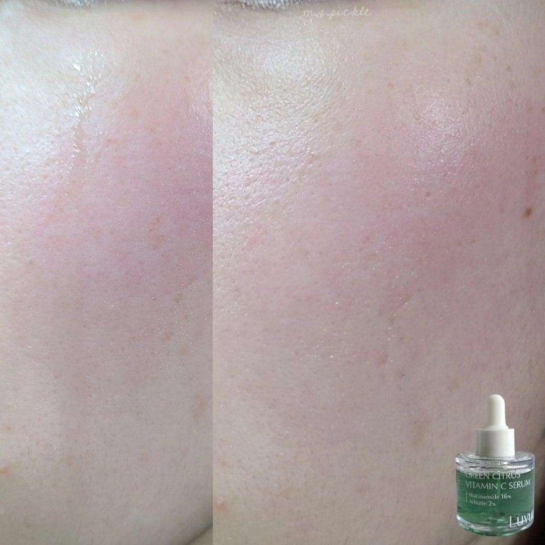 ピックル@美容垢 on LIPS 「Luvum様よりご提供いただきました💛【グリーンシトラスビタミ..」(5枚目)