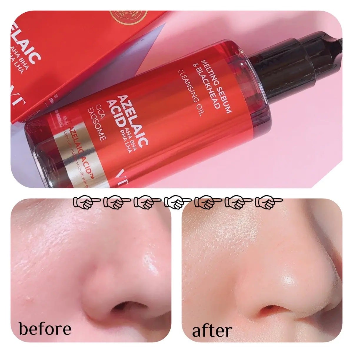 レッドブースター リードルショット100/VT/ブースター・導入液を使ったクチコミ(4枚目)