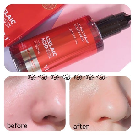 レッドブースター リードルショット100/VT/ブースター・導入液を使ったクチコミ(4枚目)