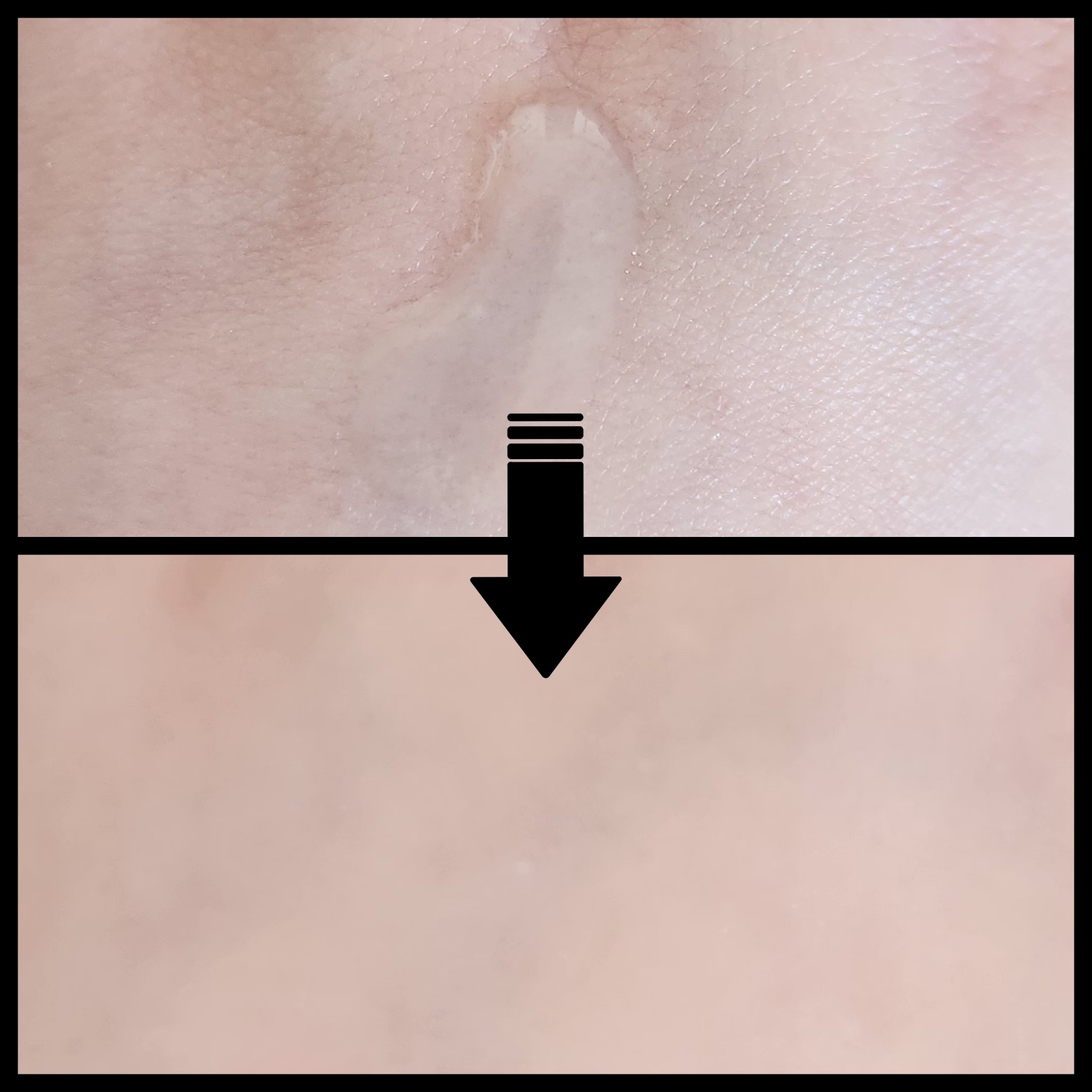 ダーマアンサーアゼライン酸ミントアンプル/CNP Laboratory/美容液を使ったクチコミ（3枚目）