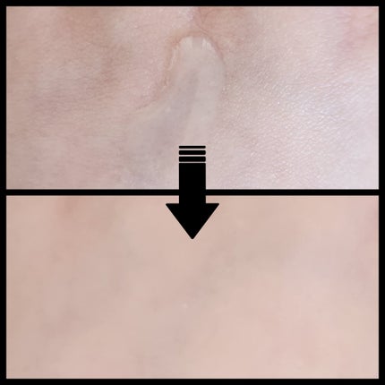 ダーマアンサーアゼライン酸ミントアンプル/CNP Laboratory/美容液を使ったクチコミ(3枚目)