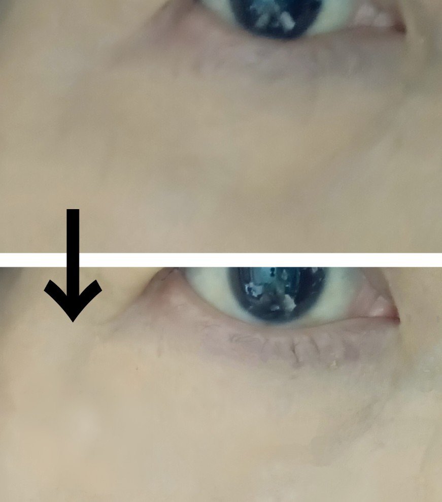 アイレノール クマクリーム/IRENOL/アイケア・アイクリームを使ったクチコミ（3枚目）