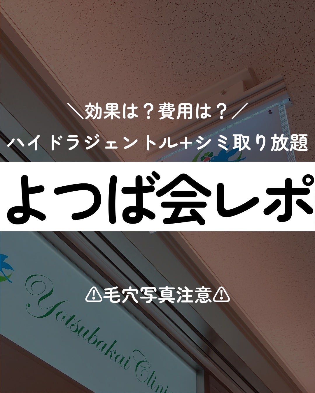 3D立体マスク/CICIBELLA/マスクを使ったクチコミ(1枚目)