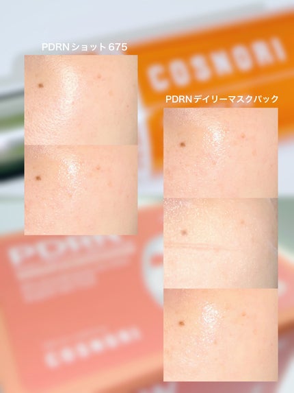 PDRNショット675/COSNORI/美容液を使ったクチコミ(4枚目)