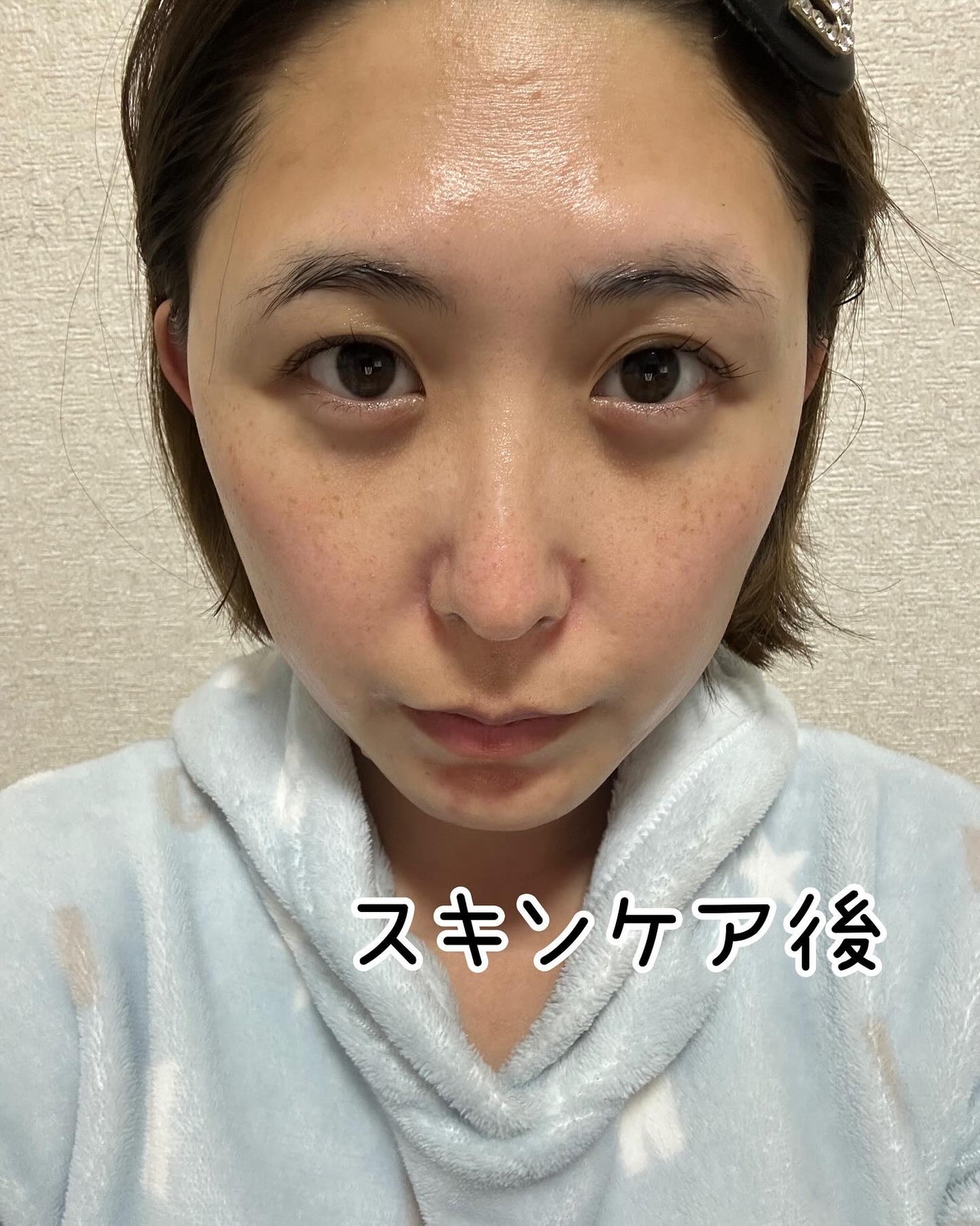 潤浸保湿 モイストリペアシートマスク/キュレル/シートマスク・パックを使ったクチコミ(4枚目)