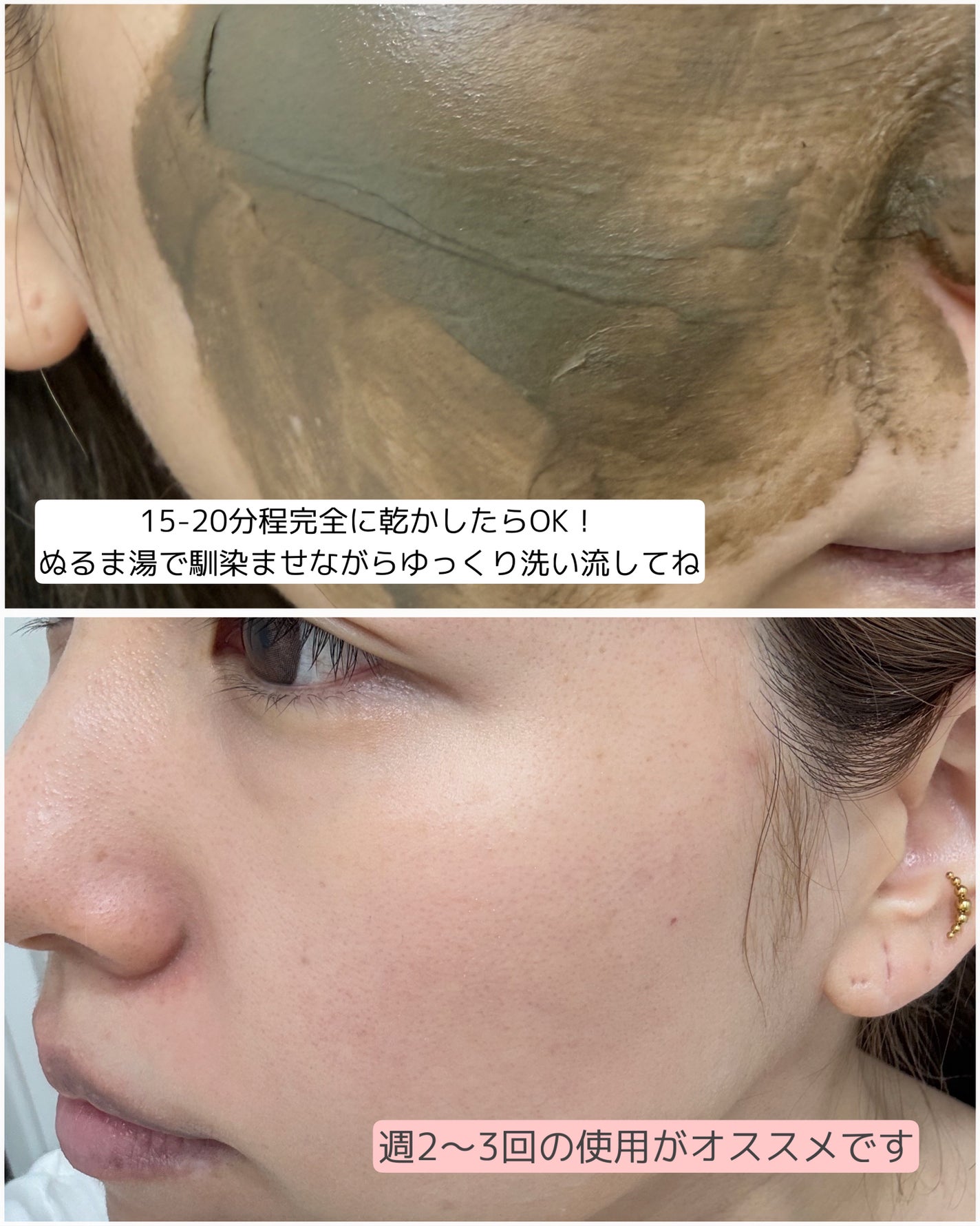 リカバリーマッドマスク/BRMUD/洗い流すパック・マスクを使ったクチコミ(3枚目)