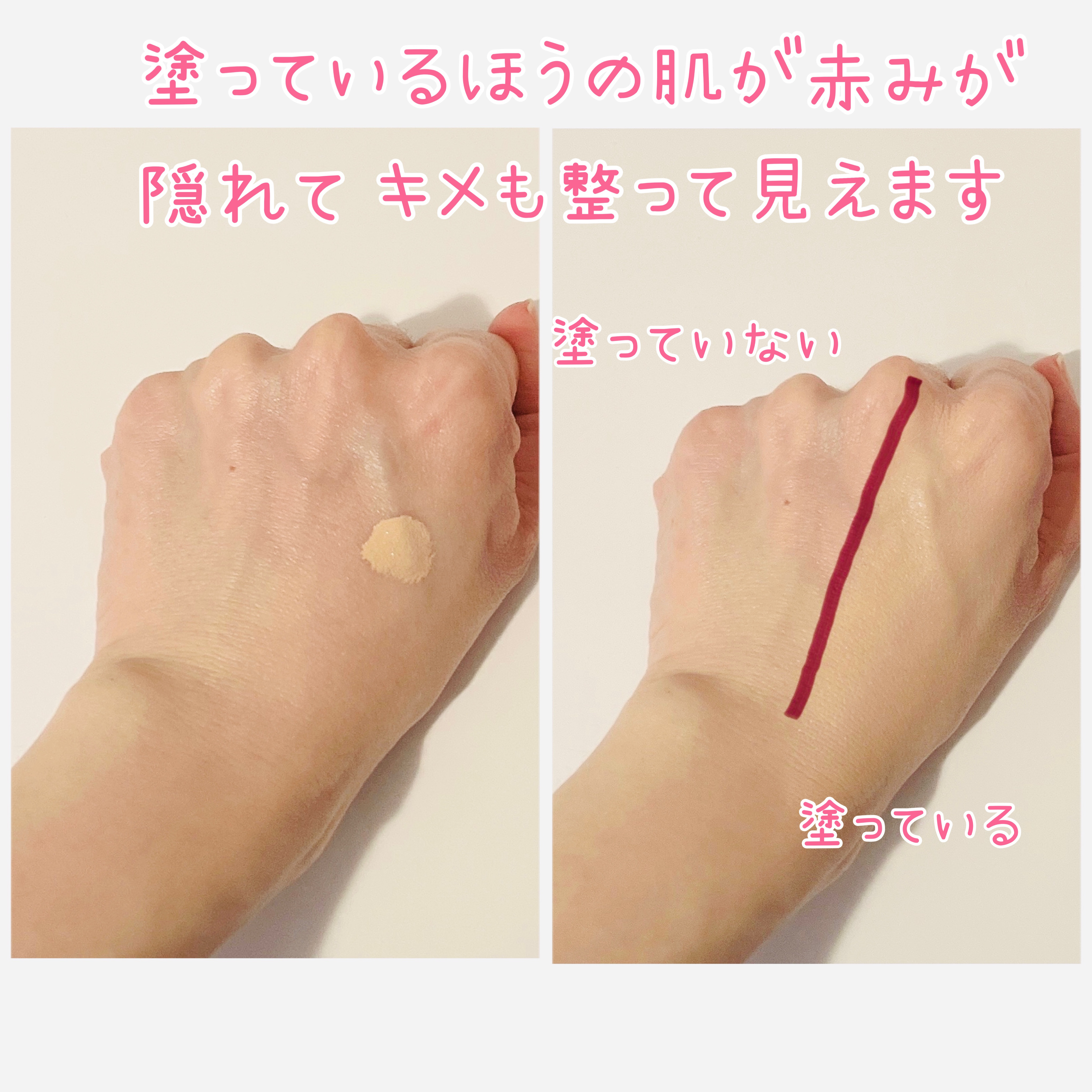 ダーマシンコンシーラー/23years old/リキッドコンシーラーを使ったクチコミ（3枚目）