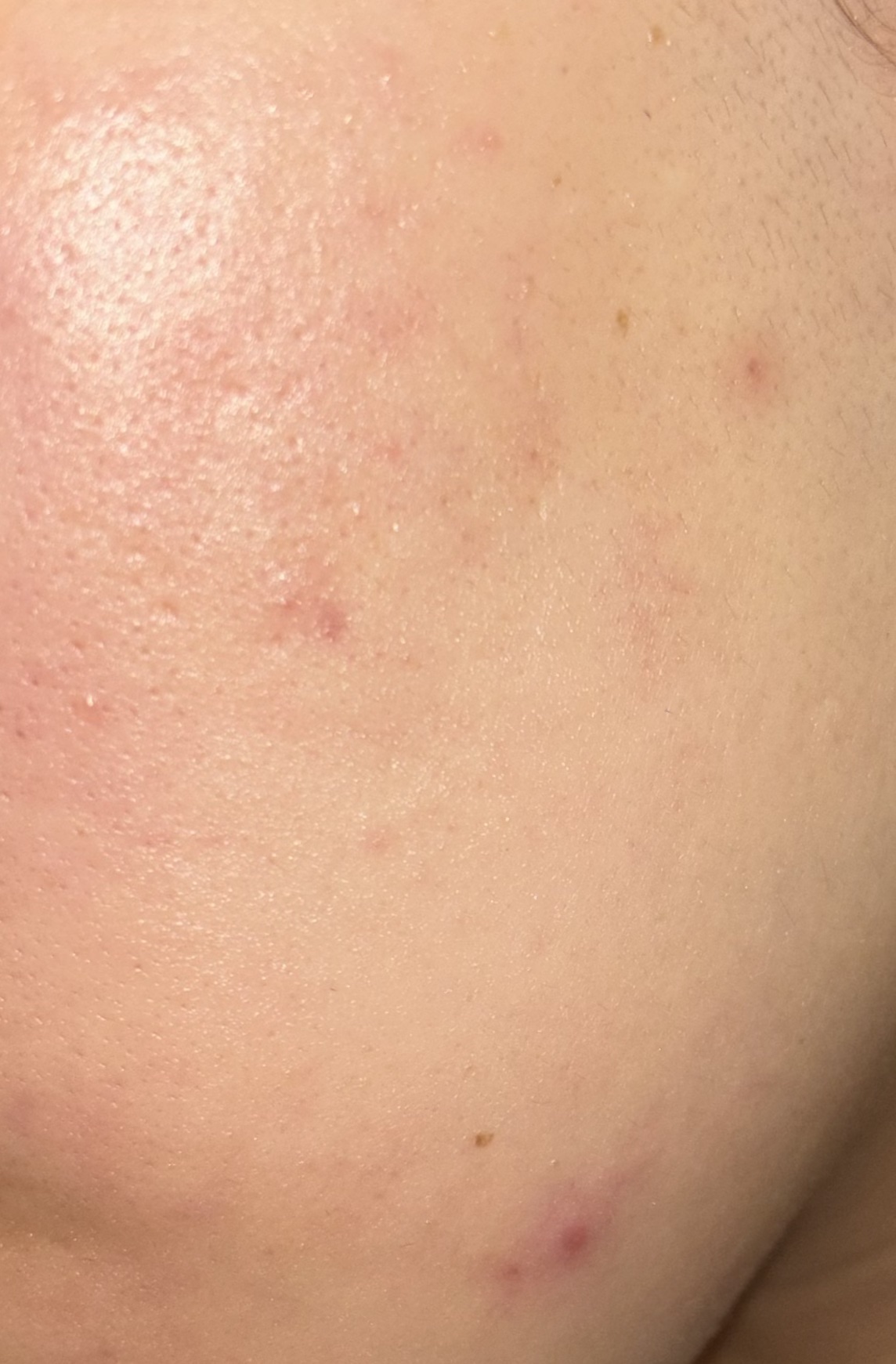 センテルリューション シカクリーム 3X 乾燥肌用/PIBUMI/フェイスクリームを使ったクチコミ（1枚目）