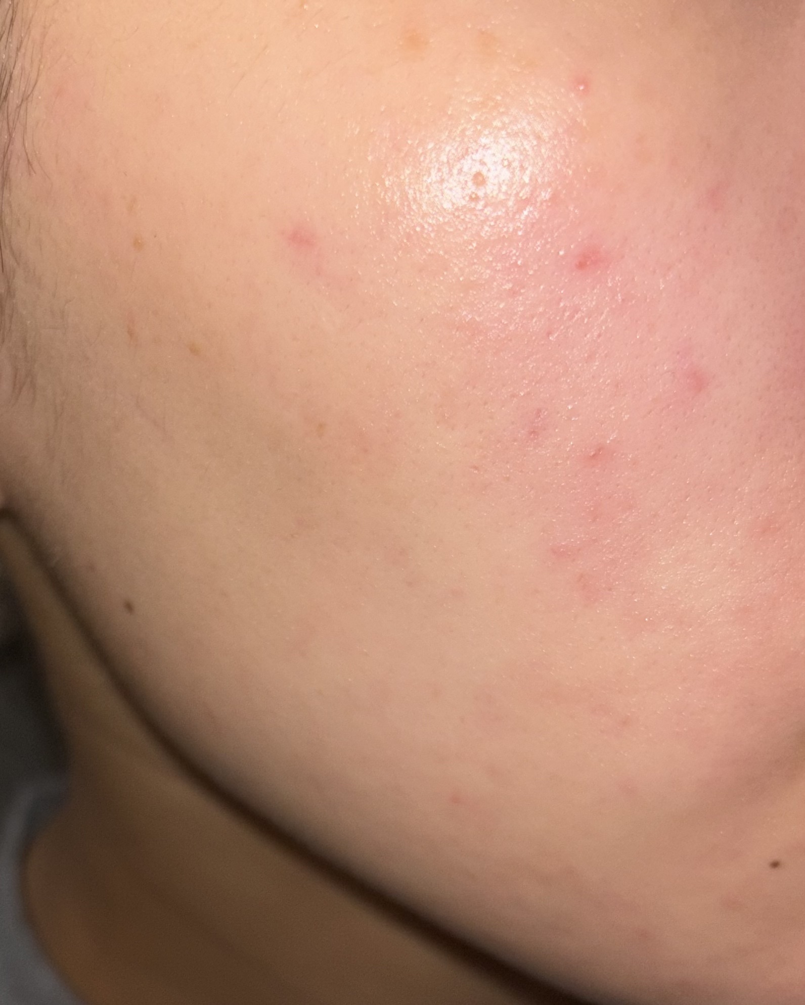 センテルリューション シカクリーム 3X 乾燥肌用/PIBUMI/フェイスクリームを使ったクチコミ（2枚目）