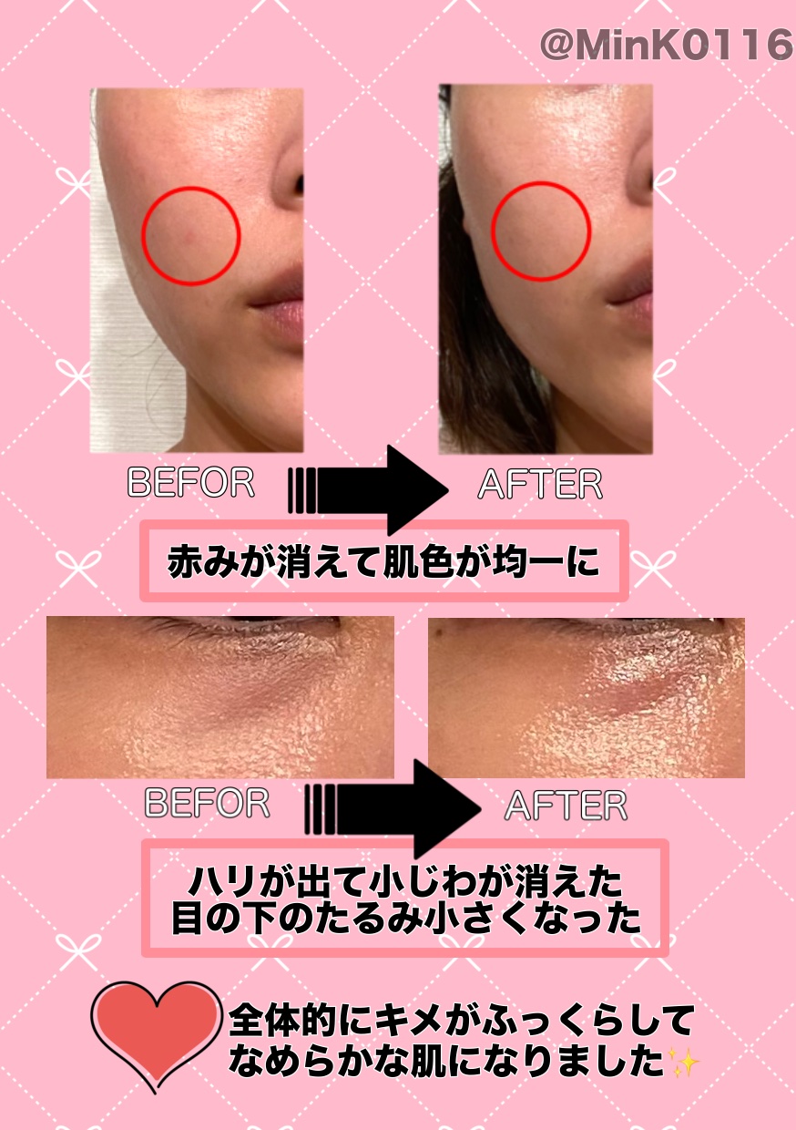 ナリス 3Dスフィアホワイト 6枚セット 試してみた】3Dスフィア WH